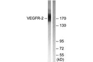 Western blot analysis of extracts from HepG2 cells, treated with Na3VO4 0. (VEGFR2/CD309 antibody  (AA 1025-1074))