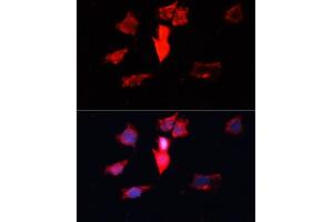 Immunofluorescence analysis of HeLa cells using C antibody (ABIN3021589, ABIN3021590, ABIN3021591 and ABIN6215299) at dilution of 1:100. (Calmodulin 3 antibody  (AA 1-100))