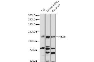 Western blot analysis of extracts of various cell lines, using PTK2B antibody (ABIN7269745) at 1:1000 dilution. (PTK2B antibody  (AA 1-100))