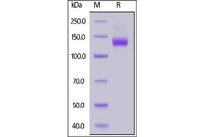 Human ACE2, Mouse IgG1 Fc Tag on  under reducing (R) condition. (ACE2 Protein (AA 18-740) (mFc Tag))