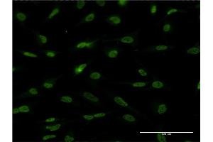 Immunofluorescence of monoclonal antibody to EPAS1 on HeLa cell. (EPAS1 antibody  (AA 28-347))
