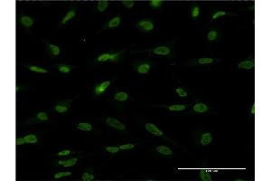Immunofluorescence of monoclonal antibody to EPAS1 on HeLa cell.