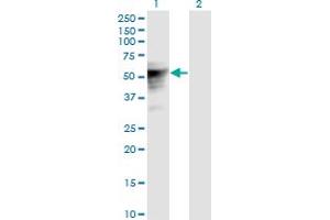 Western Blot analysis of TLE6 expression in transfected 293T cell line by TLE6 monoclonal antibody (M01), clone 2E4.