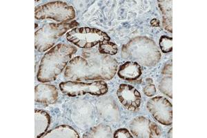 Immunohistochemical staining (Formalin-fixed paraffin-embedded sections) of human kidney with CA12 monoclonal antibody, clone CL0278  shows strong membranous immunoreactivity in renal tubules, but not glomeruli.
