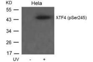 Western blot analysis of extracts from Hela cells untreated or treated with UV using ATF4(Phospho-Ser245) Antibody. (ATF4 antibody  (pSer245))