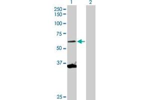 Western Blot analysis of SCMH1 expression in transfected 293T cell line by SCMH1 MaxPab polyclonal antibody. (SCMH1 antibody  (AA 1-660))
