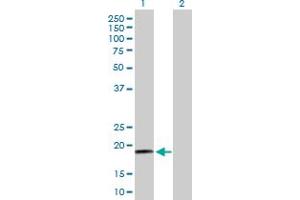 Western Blot analysis of RPS19 expression in transfected 293T cell line by RPS19 MaxPab polyclonal antibody. (RPS19 antibody  (AA 1-145))