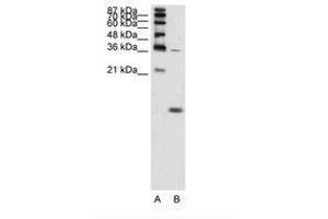 Image no. 2 for anti-Hemoglobin, zeta (HBZ) (AA 31-80) antibody (ABIN204990) (HBZ antibody  (AA 31-80))