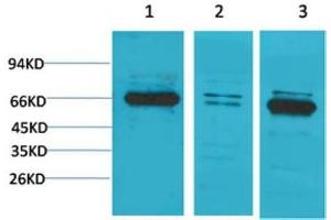 Western Blot (WB) analysis of 1) PC3, 2)Mouse Brain Tissue, 3) Rat Brain Tissue with Bestrophin-1 Rabbit Polyclonal Antibody diluted at 1:2000. (Bestrophin 1 antibody)