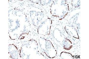 IHC staining of human prostate (10X) with HMW Cytokeratin antibody (34bE12). (KRT1 antibody)