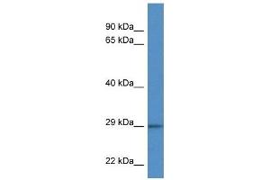 Western Blot showing F11R antibody used at a concentration of 1 ug/ml against Hela Cell Lysate (F11R antibody  (C-Term))