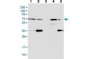 Western blot analysis of Lane 1: RT-4, Lane 2: U-251 MG, Lane 3: Human Plasma, Lane 4: Liver, Lane 5: Tonsil with ZNF609 polyclonal antibody  at 1:100-1:250 dilution.