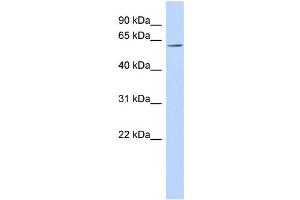 WB Suggested Anti-FLJ14803 Antibody Titration: 0. (TMEM209 antibody  (N-Term))
