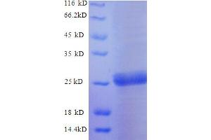 SDS-PAGE (SDS) image for Trehalase (Brush-Border Membrane Glycoprotein) (TREH) (AA 546-751), (partial) protein (His tag) (ABIN4975105) (TREH Protein (AA 546-751, partial) (His tag))