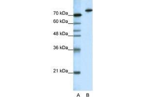 Western Blotting (WB) image for anti-Kelch-Like 3 (KLHL3) antibody (ABIN2461880) (KLHL3 antibody)