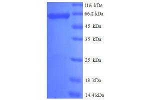 SDS-PAGE (SDS) image for Plasminogen Activator Inhibitor 2 (SERPINB2) (AA 1-416), (full length) protein (His-SUMO Tag) (ABIN4976966) (SERPINB2 Protein (AA 1-416, full length) (His-SUMO Tag))