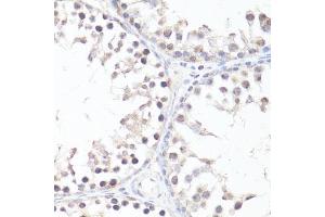 Immunohistochemistry of paraffin-embedded rat testis using P-MYC-T58 antibody (ABIN3019538, ABIN3019539, ABIN3019540 and ABIN6225454) at dilution of 1:100 (40x lens). (c-MYC antibody  (pThr58))