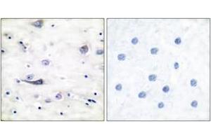 Immunohistochemistry analysis of paraffin-embedded human brain, using GluR1 (Phospho-Ser863) Antibody.