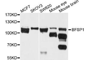 Western blot analysis of extract of various cells, using BFSP1 antibody. (Filensin antibody)