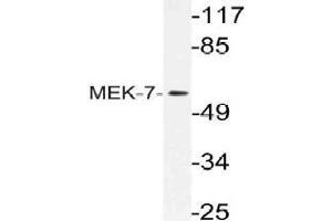 Western blot (WB) analysis of MEK-7 antibody in extracts from HeLa cells. (MAP2K7 antibody)