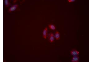 ABIN6276062 staining HeLa cells by ICC/IF. (NPY2R antibody  (N-Term))