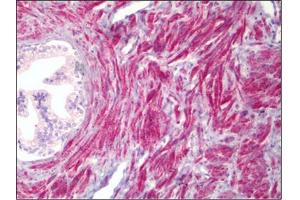 Human Prostate, Smooth Muscle: Formalin-Fixed, Paraffin-Embedded (FFPE) (PMEPA1 antibody)