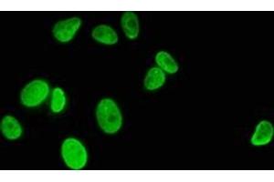 Immunofluorescence staining of MCF-7 cells with ABIN7139594 at 1:5, counter-stained with DAPI. (HIST1H1C antibody  (meLys186))