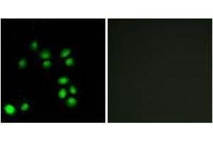 Immunofluorescence analysis of A549 cells, using EXO1 Antibody.