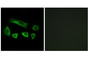 Immunofluorescence analysis of A549 cells, using NT5C1B antibody. (NT5C1B antibody  (Internal Region))