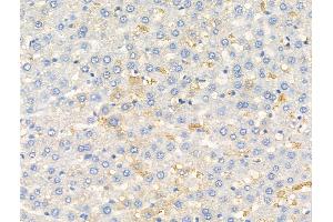 anti-Ring Finger Protein 31 (RNF31) (Internal Region) antibody