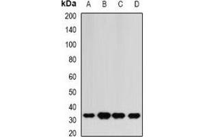 Western blot analysis of HAGH expression in HepG2 (A), mouse liver (B), mouse heart (C), rat kidney (D) whole cell lysates. (HAGH antibody)