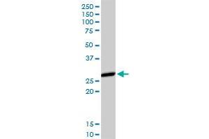 HLA-DMA MaxPab rabbit polyclonal antibody. (HLA-DMA antibody  (AA 1-261))