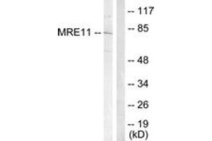 Western blot analysis of extracts from Jurkat cells, treated with UV 15', using MRE11 (Ab-264) Antibody.