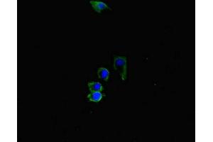 Immunofluorescent analysis of HepG2 cells using ABIN7169164 at dilution of 1:100 and Alexa Fluor 488-congugated AffiniPure Goat Anti-Rabbit IgG(H+L) (ACVRL1 antibody  (AA 22-118))