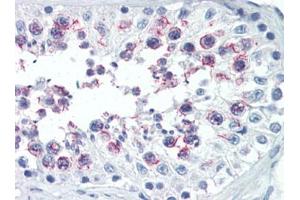 Human Testis (formalin-fixed, paraffin-embedded) stained with SMURF1followed by biotinylated goat anti-rabbit IgG secondary antibody, alkaline phosphatase-streptavidin and chromogen. (SMURF1 antibody  (N-Term))