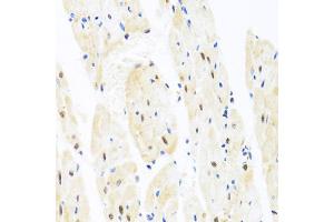 Immunohistochemistry of paraffin-embedded rat heart using TAF9 antibody (ABIN1875018) at dilution of 1:100 (40x lens).