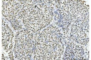 IHC analysis of Cyclophilin E/PPIE using anti-Cyclophilin E/PPIE antibody (ABIN7599242). (PPIE antibody  (AA 1-301))