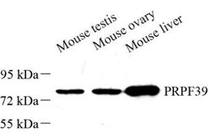 Western blot analysis of PRPF39 (ABIN7075170) at dilution of 1: 500 (PRPF39 antibody)