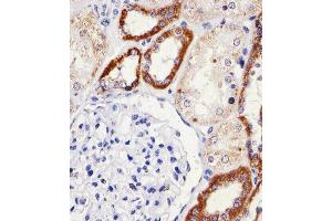 Immunohistochemical analysis of paraffin-embedded H. (Sorting Nexin 3 antibody  (AA 78-105))