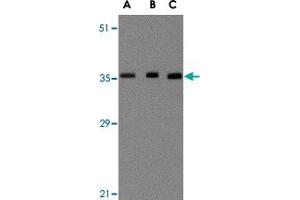 Western blot analysis of BRCC3 in MCF-7 cell lysate with BRCC3 polyclonal antibody  at (A) 0.