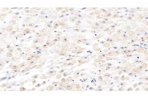 Detection of MMP8 in Human Placenta Tissue using Monoclonal Antibody to Matrix Metalloproteinase 8 (MMP8) (MMP8 antibody  (AA 101-467))