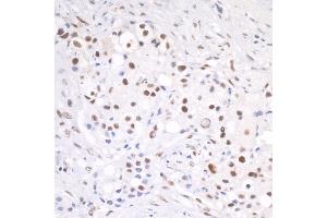anti-Cleavage Stimulation Factor, 3' Pre-RNA, Subunit 2, 64kDa (CSTF2) (AA 375-425) antibody