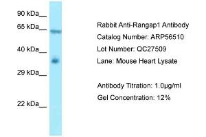 Western Blotting (WB) image for anti-Ran GTPase Activating Protein 1 (RANGAP1) (N-Term) antibody (ABIN2786744) (RANGAP1 antibody  (N-Term))