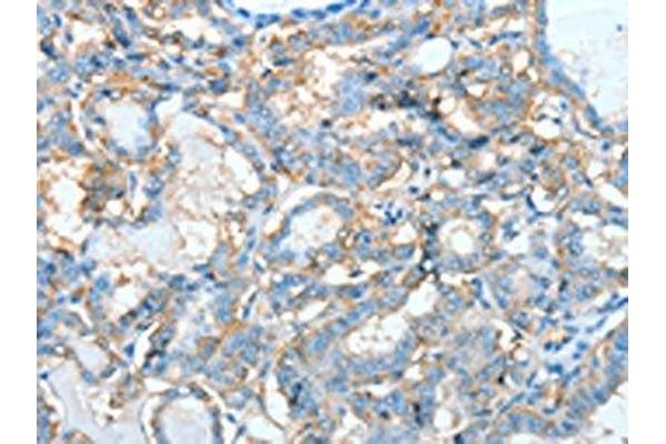 AGBL3 antibody