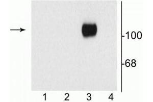Western blot of 10 µg of HEK 293 cells showing specific immunolabeling of the ~120 kDa NR1 subunit of the NMDA receptor containing the C1 splice variant insert (in lane 3). (GRIN1/NMDAR1 antibody)
