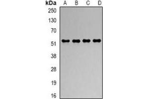 Western blot analysis of RbAp48 expression in Hela (A), Jurkat (B), NIH3T3 (C), COS7 (D) whole cell lysates.