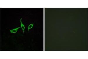 Immunofluorescence analysis of LOVO cells, using GPR120 Antibody. (O3FAR1 antibody  (AA 221-270))