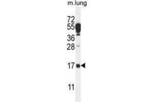 Western Blotting (WB) image for anti-Chromosome 14 Open Reading Frame 126 (C14orf126) antibody (ABIN2995710)