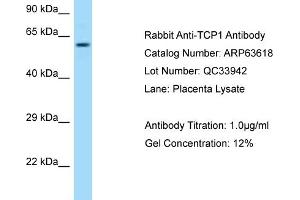 Western Blotting (WB) image for anti-T-Complex 1 (TCP1) (C-Term) antibody (ABIN2789568) (TCP1 alpha/CCTA antibody  (C-Term))
