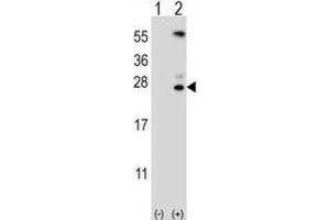 Western Blotting (WB) image for anti-Kallikrein 6 (KLK6) antibody (ABIN3002615) (Kallikrein 6 antibody)